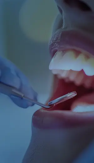 soft tissue & aesthetic gum procedures (1)