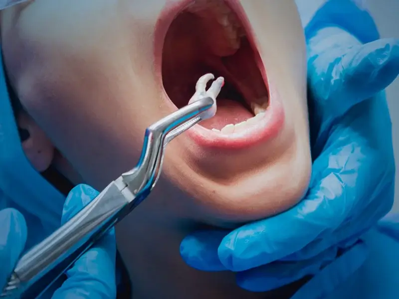 extractions regenerative care