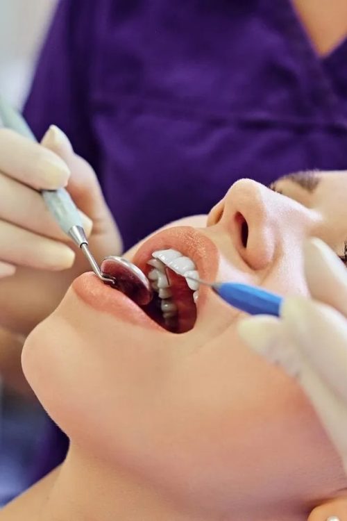 imgi 16 close up image dentist examining female s teeth dentistry 613910 1726 2880w